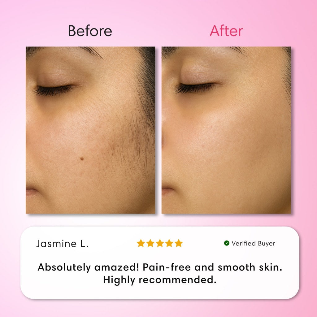 Balilux Kit Triple Depilación