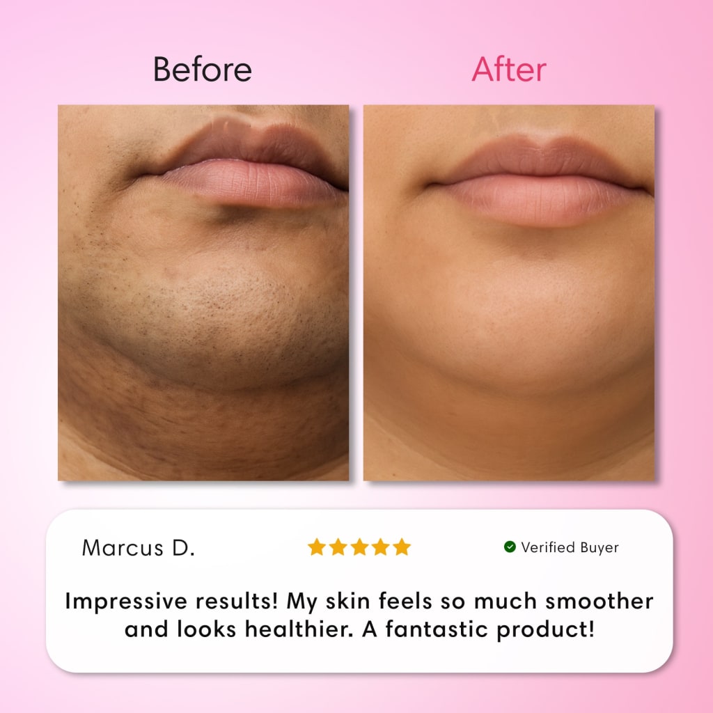 Balilux Kit Triple Depilación