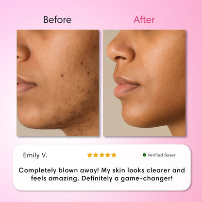 Balilux Kit Triple Depilación