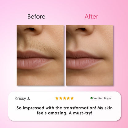 Balilux Kit Triple Depilación